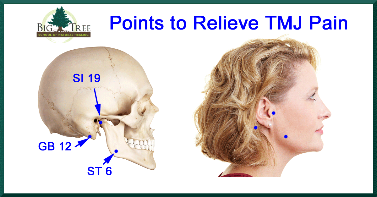TMJ: what is it and how can a chiropractor help